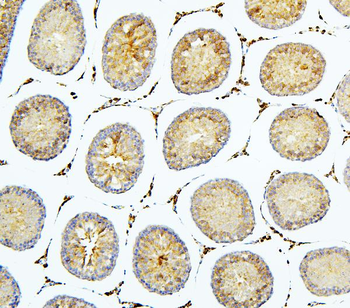 BubR1/BUB1B Rabbit Polyclonal Antibody