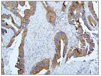 BubR1/BUB1B Rabbit Polyclonal Antibody