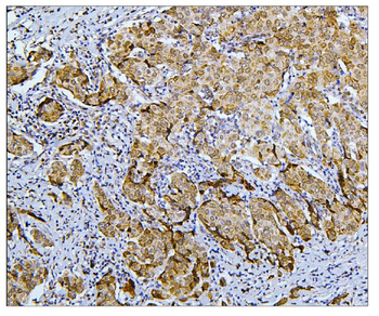 BubR1/BUB1B Rabbit Polyclonal Antibody