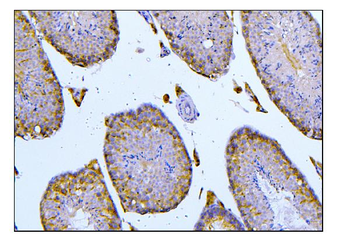 BubR1/BUB1B Rabbit Polyclonal Antibody