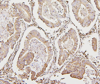 Calreticulin/CALR Rabbit Polyclonal Antibody