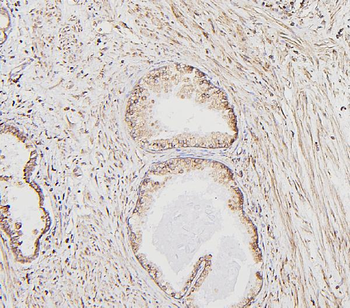 Calreticulin/CALR Rabbit Polyclonal Antibody