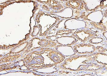 Calreticulin/CALR Rabbit Polyclonal Antibody