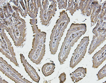 Calreticulin/CALR Rabbit Polyclonal Antibody