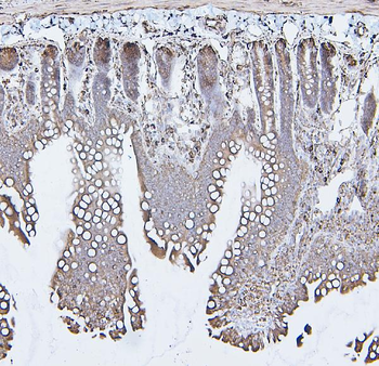 Calreticulin/CALR Rabbit Polyclonal Antibody
