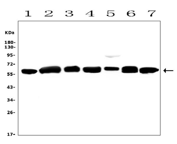 Calreticulin/CALR Rabbit Polyclonal Antibody