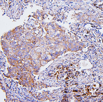 CETP Rabbit Polyclonal Antibody