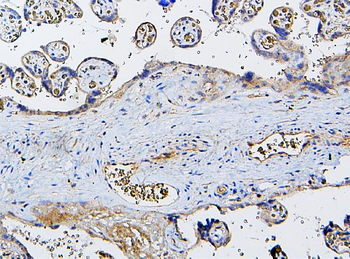 CETP Rabbit Polyclonal Antibody