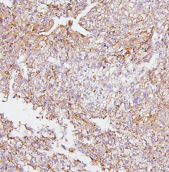Cytochrome P450 2E1/CYP2E1 Rabbit Polyclonal Antibody