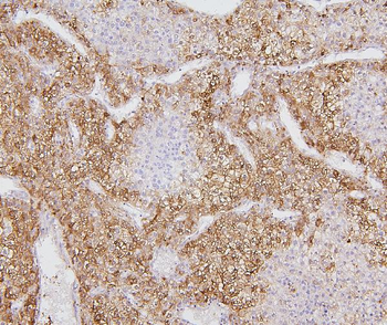 Cytochrome P450 2E1/CYP2E1 Rabbit Polyclonal Antibody