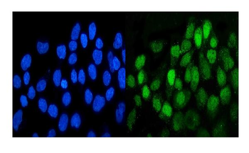 MCK10/NEP/DDR1 Rabbit Polyclonal Antibody