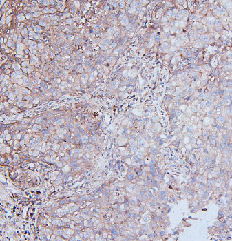 MCK10/NEP/DDR1 Rabbit Polyclonal Antibody