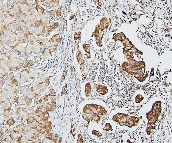 MCK10/NEP/DDR1 Rabbit Polyclonal Antibody