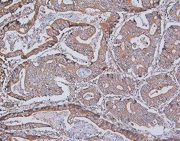 MCK10/NEP/DDR1 Rabbit Polyclonal Antibody
