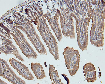 MCK10/NEP/DDR1 Rabbit Polyclonal Antibody