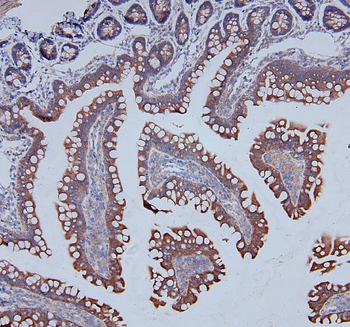 MCK10/NEP/DDR1 Rabbit Polyclonal Antibody