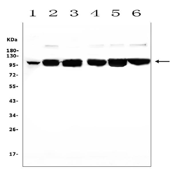 MCK10/NEP/DDR1 Rabbit Polyclonal Antibody