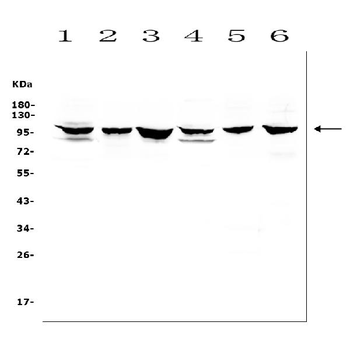 MCK10/NEP/DDR1 Rabbit Polyclonal Antibody