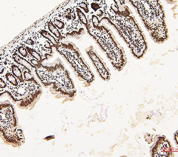 DDX5 Rabbit Polyclonal Antibody