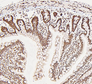 DDX5 Rabbit Polyclonal Antibody