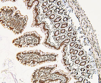 DDX5 Rabbit Polyclonal Antibody