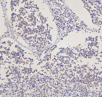 Metabotropic glutamate receptor 2/GRM2 Rabbit Polyclonal Antibody