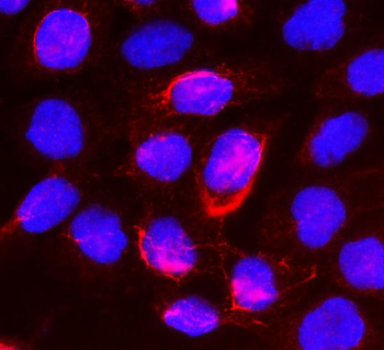 beta glucuronidase/GUSB Rabbit Polyclonal Antibody
