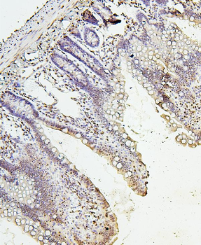 Histone H1.0/H1F0/H1 Rabbit Polyclonal Antibody