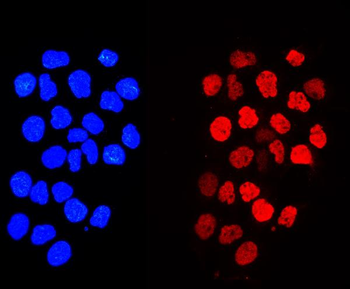 Histone H1.0/H1F0/H1 Rabbit Polyclonal Antibody