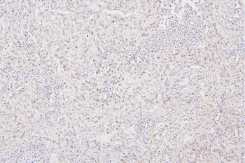 Histone H1.0/H1F0/H1 Rabbit Polyclonal Antibody