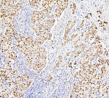 Histone H1.0/H1F0/H1 Rabbit Polyclonal Antibody