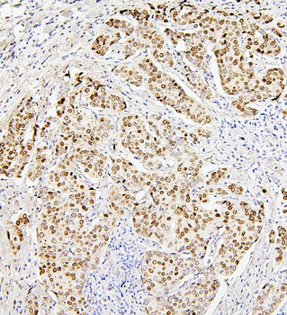 Histone H1.0/H1F0/H1 Rabbit Polyclonal Antibody