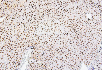 Histone H1.0/H1F0/H1 Rabbit Polyclonal Antibody