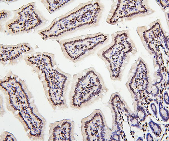 Histone H1.0/H1F0/H1 Rabbit Polyclonal Antibody