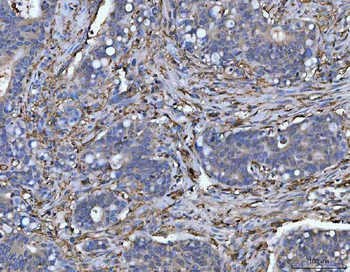 HLA-DR/HLA-DRA/HLA Rabbit Polyclonal Antibody