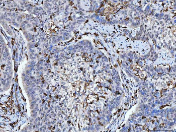 HLA-DR/HLA-DRA/HLA Rabbit Polyclonal Antibody