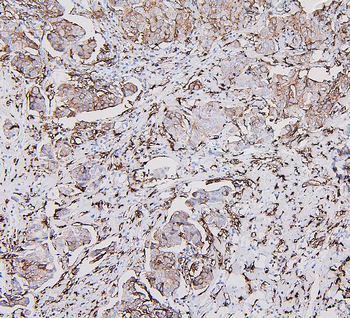 HLA-DR/HLA-DRA/HLA Rabbit Polyclonal Antibody