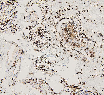 HLA-DR/HLA-DRA/HLA Rabbit Polyclonal Antibody