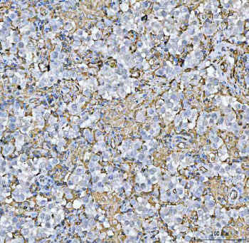HLA-DR/HLA-DRA/HLA Rabbit Polyclonal Antibody