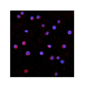 IRAK-1/IRAK1/IRAK Rabbit Polyclonal Antibody