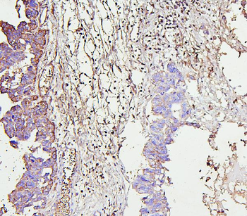 IRAK-1/IRAK1/IRAK Rabbit Polyclonal Antibody