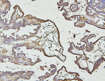 IRAK-1/IRAK1/IRAK Rabbit Polyclonal Antibody