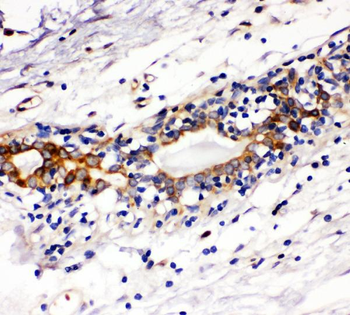 c-Kit/Kit Rabbit Polyclonal Antibody