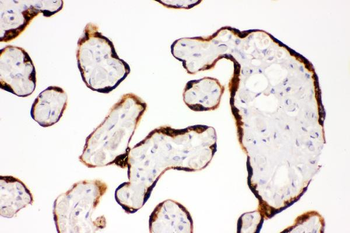 c-Kit/Kit Rabbit Polyclonal Antibody