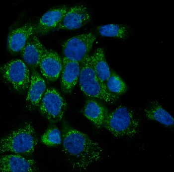 Lipoma-preferred partner LPP Rabbit Polyclonal Antibody