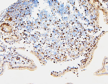 MCM2 Rabbit Polyclonal Antibody