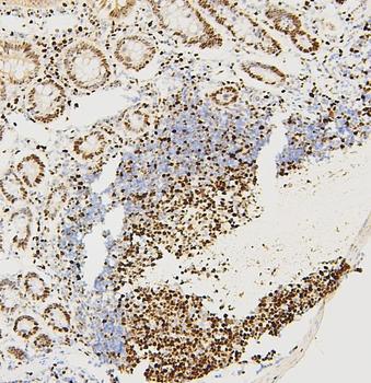 MCM2 Rabbit Polyclonal Antibody