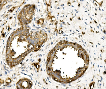 Moesin/MSN Rabbit Polyclonal Antibody