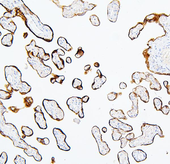 MTR Rabbit Polyclonal Antibody