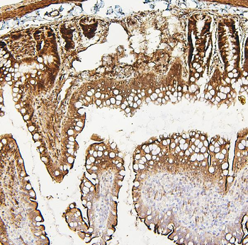 PXR/NR1I2 Rabbit Polyclonal Antibody